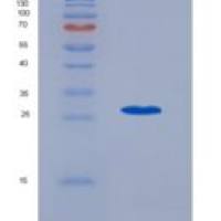 大鼠信号淋巴细胞激活分子家族成员1(SLAMF1)重组蛋白