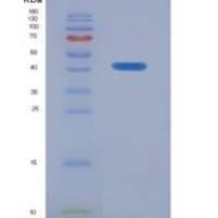 人碱性唾液脯氨酸丰富蛋白1(PRB1)重组蛋白