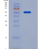 人核糖核酸酶T2(RNASET2)重组蛋白