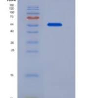 人核糖核酸酶T2(RNASET2)重组蛋白