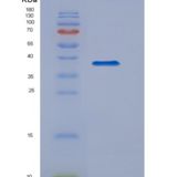 人TANK结合激酶1(TBK1)重组蛋白