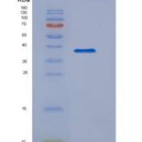人TANK结合激酶1(TBK1)重组蛋白