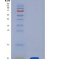 小鼠胰岛素样生长因子2(IGF2)重组蛋白