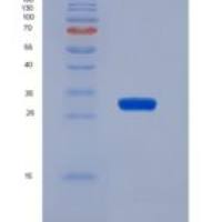 小鼠前列腺特异性膜抗原(PMSA)重组蛋白