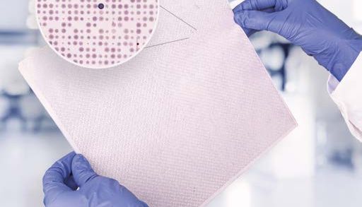 Engine 蛋白阵列芯片