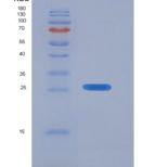 人肌球蛋白重链11(MYH11)重组蛋白