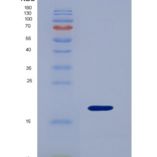 大鼠D类清道夫受体1(SCARD1)重组蛋白