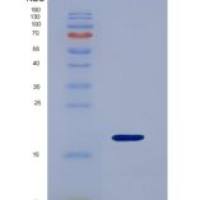 大鼠D类清道夫受体1(SCARD1)重组蛋白