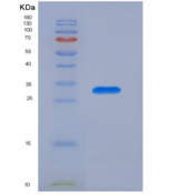 人胰岛素受体底物1(IRS1)重组蛋白