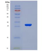 人纤连蛋白亮氨酸丰富跨膜蛋白2(FLRT2)重组蛋白