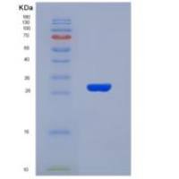 人纤连蛋白亮氨酸丰富跨膜蛋白2(FLRT2)重组蛋白