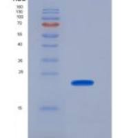 小鼠层粘连蛋白γ1(LAMC1)重组蛋白