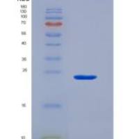 小鼠晶状体蛋白αB(CRYaB)重组蛋白
