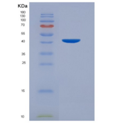 大鼠血管内皮钙黏蛋白(CDH5)重组蛋白