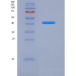 人转铁蛋白受体2(TFR2)重组蛋白