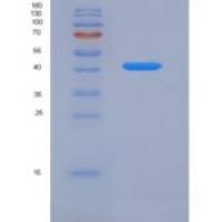 人转铁蛋白受体2(TFR2)重组蛋白