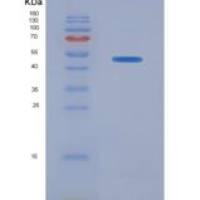 人弗林蛋白酶(FUR)重组蛋白