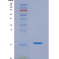 大鼠重肽神经丝蛋白(NEFH)重组蛋白