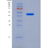 小鼠α1-抗胰糜蛋白酶(a1ACT)重组蛋白