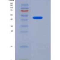 小鼠α1-抗胰糜蛋白酶(a1ACT)重组蛋白