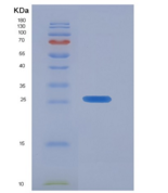 人肌球蛋白重链11(MYH11)重组蛋白