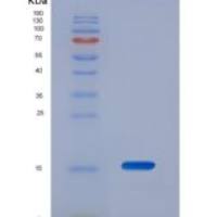 人髓过氧化物酶(MPO)重组蛋白