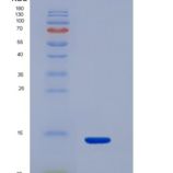 人腺苷酸环化酶关联蛋白1(CAP1)重组蛋白