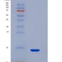 人腺苷酸环化酶关联蛋白1(CAP1)重组蛋白