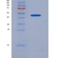 人补体因子H(CFH)重组蛋白