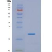 人肉毒碱棕榈酰基转移酶1A(CPT1A)重组蛋白