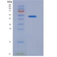 人角蛋白18(CK18)重组蛋白
