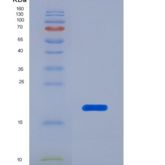 人淀粉样β肽1-40重组蛋白 (Ab1-40)