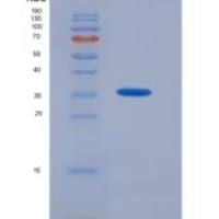 人蛋白酪氨酸磷酸酶受体S(PTPRS)重组蛋白