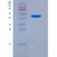 小鼠前脑啡肽(PENK)重组蛋白