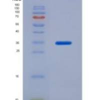 大鼠层粘连蛋白γ1(LAMC1)重组蛋白