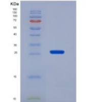 人叉头框蛋白A1(FOXA1)重组蛋白