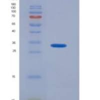 人胰淀粉酶α2(AMY2A)重组蛋白