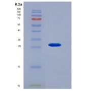 大鼠核因子κB受体激活因子(RANk)重组蛋白