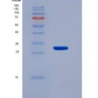 人类胰蛋白酶(TPS)重组蛋白