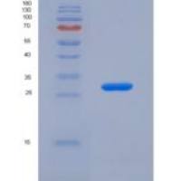 人血小板衍生生长因子A(PDGFA)重组蛋白