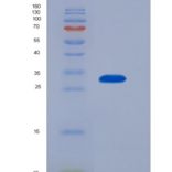 人白介素4诱导蛋白1(IL4I1)重组蛋白