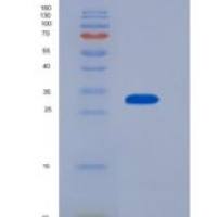 人白介素4诱导蛋白1(IL4I1)重组蛋白