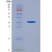 人雄激素受体(AR)重组蛋白