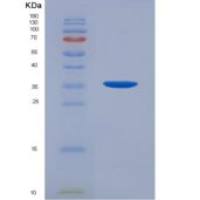 人雄激素受体(AR)重组蛋白