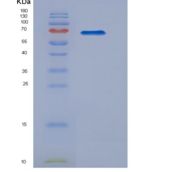 大鼠信号素4D(SEMA4D)重组蛋白
