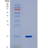 人胃动素(MTL)重组蛋白