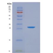 人酪蛋白α(CSN1)重组蛋白