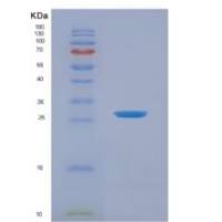 人酪蛋白α(CSN1)重组蛋白