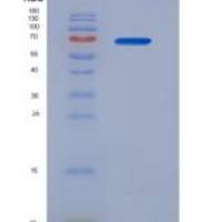 人嗜酸性粒细胞过氧化物酶(EPX)重组蛋白
