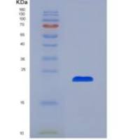 小鼠含溴区蛋白8(BRD8)重组蛋白